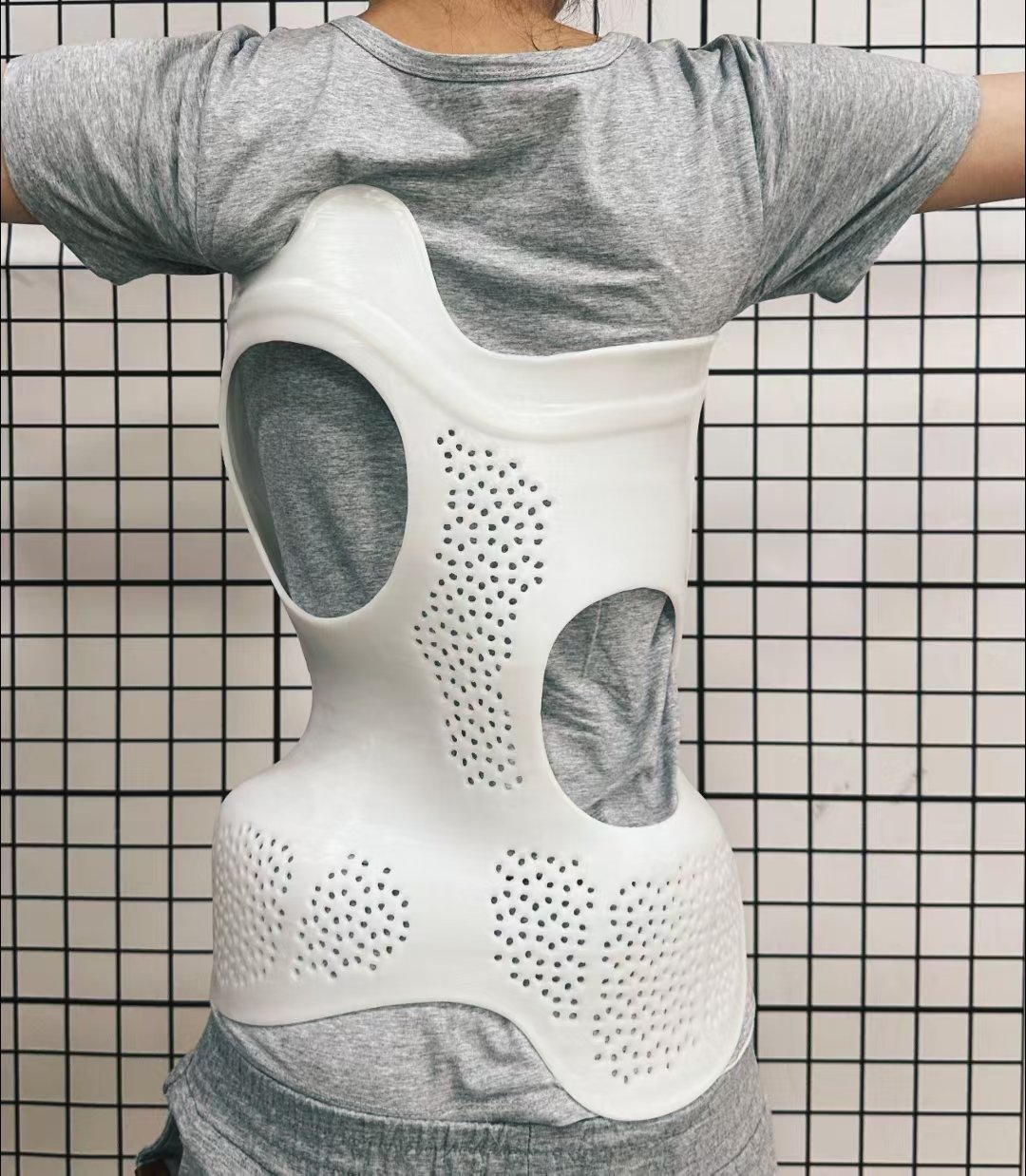 關(guān)注青少年脊柱側(cè)彎